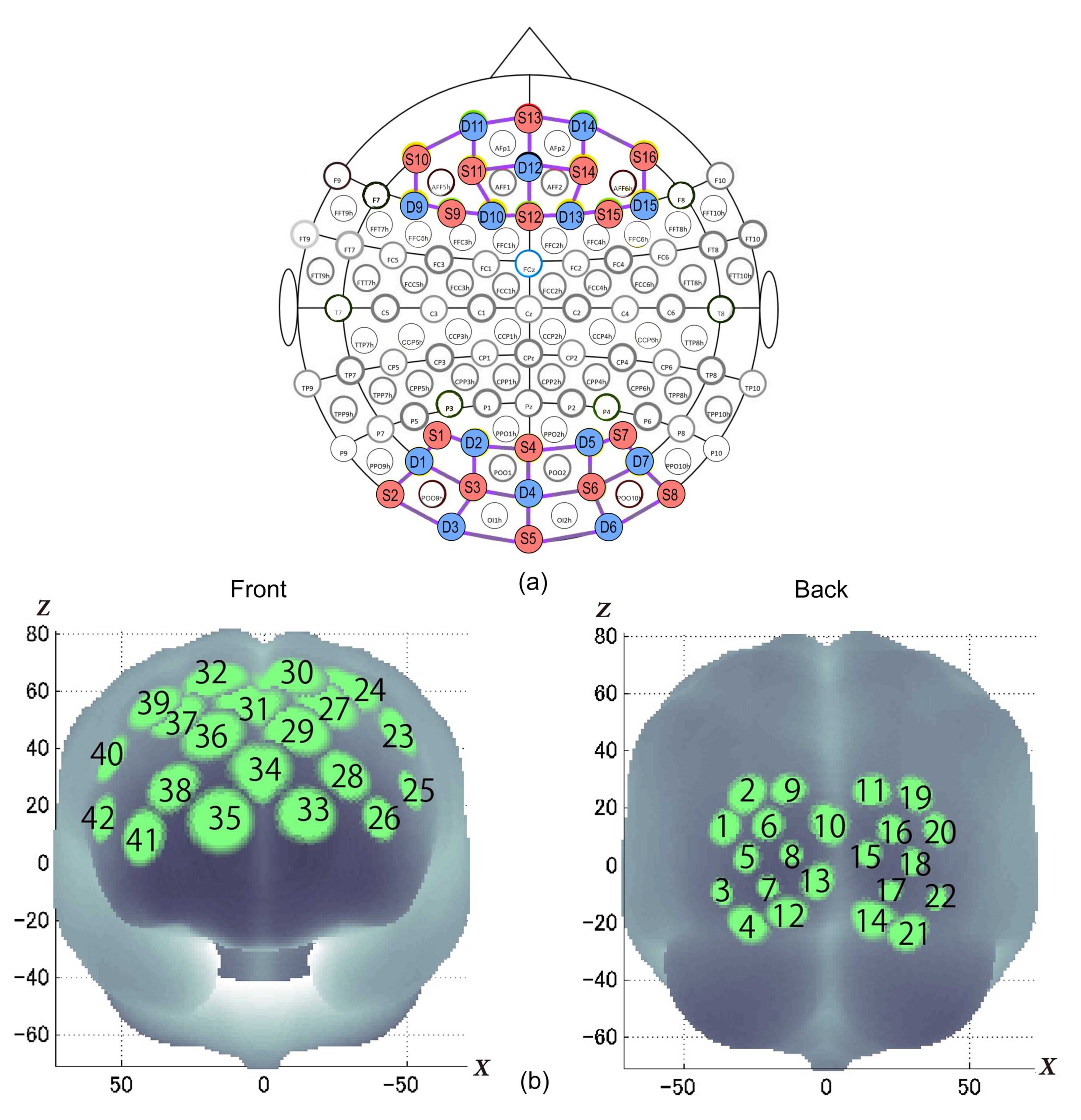 fNIRS brain